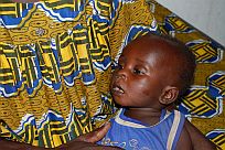 Malaria ist besonders gefährlich für Kleinkinder, wenn sie nicht behandelt wird.